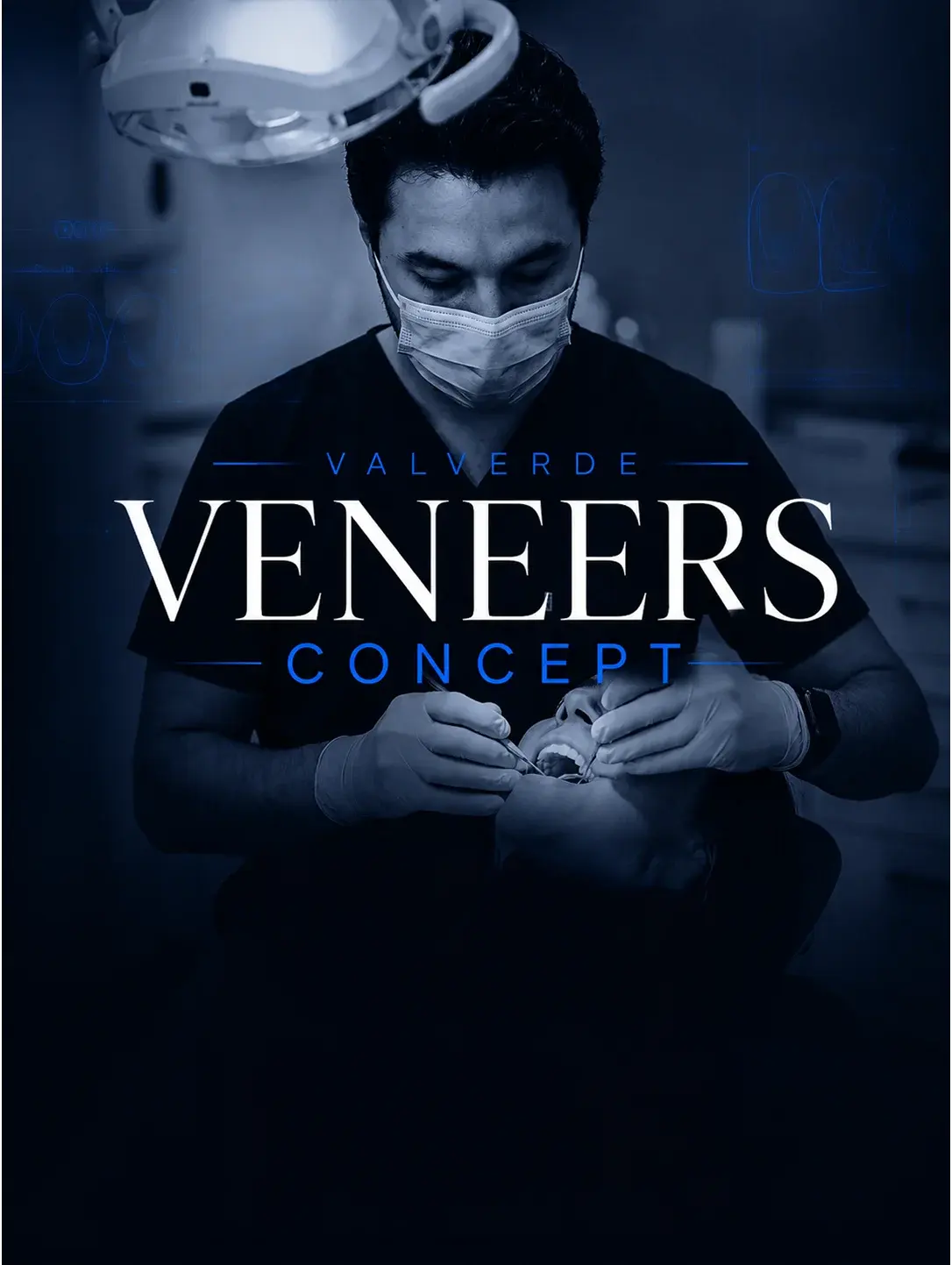 Valverde Veneers Concept
